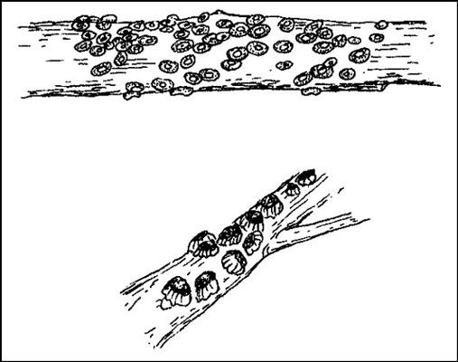 طرد الحشرات التي تتغذى على نباتات الحاويات